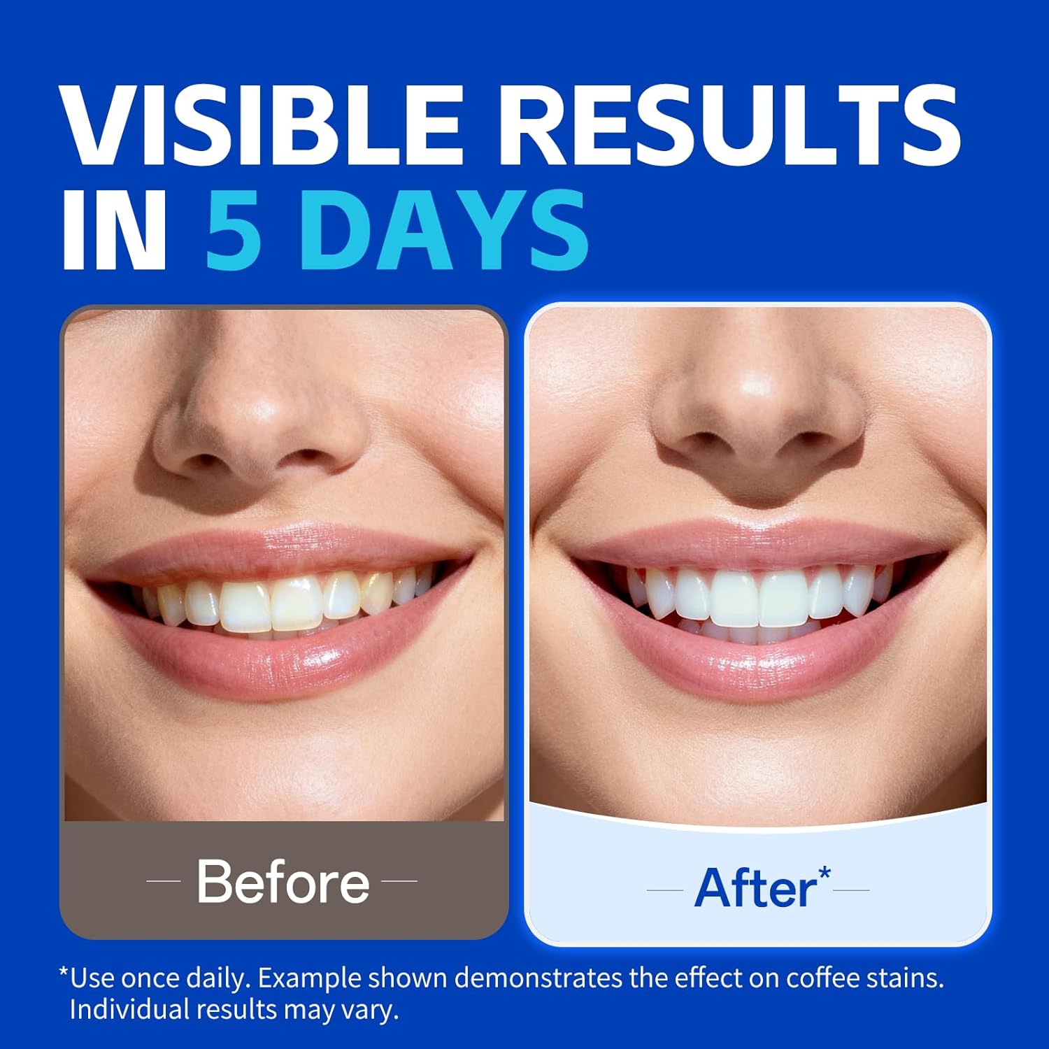 1/7 Pairs Teeth Whitening Stri - Teeth Whitening Strips Permanent ulasan dan harga