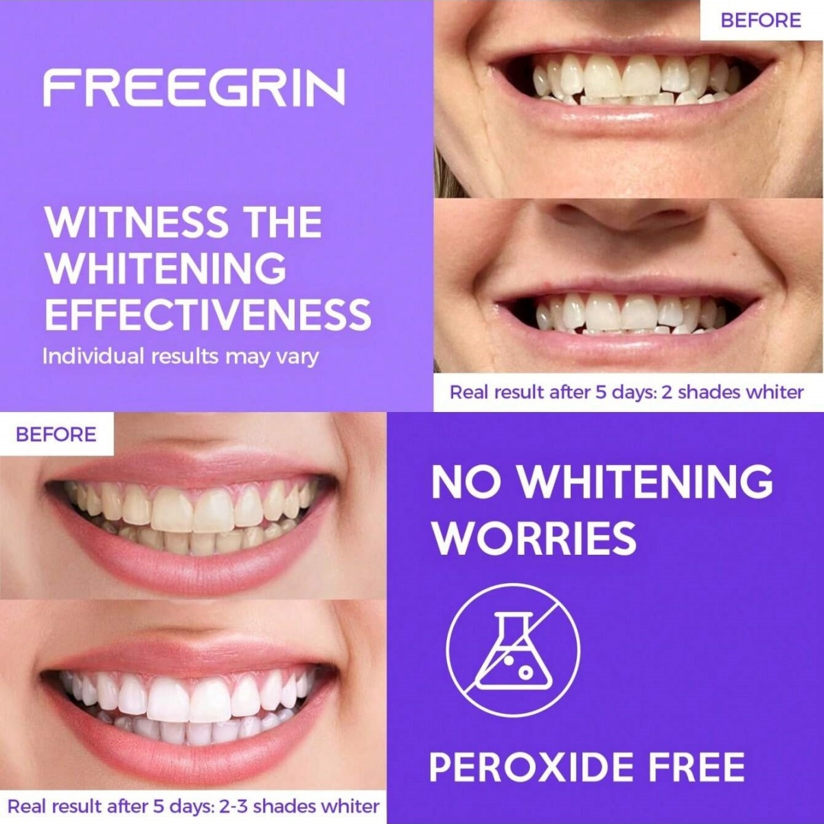 Deluxe Whitening Teeth Sticker - Teeth Whitening Doctor ulasan dan harga